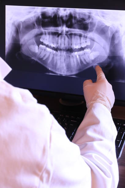 Best Emergency Wisdom Teeth Removal in Brent, FL
