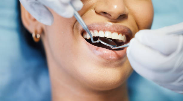 Best Walk-In Emergency Dentist in Brent, FL